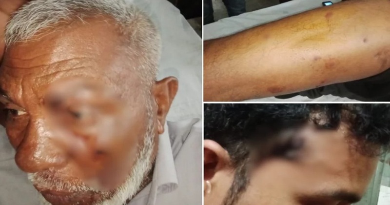 পদ্মা নদীতে টহলরত নৌ পুলিশের ওপর হামলায় গুলিতে আহতরা।