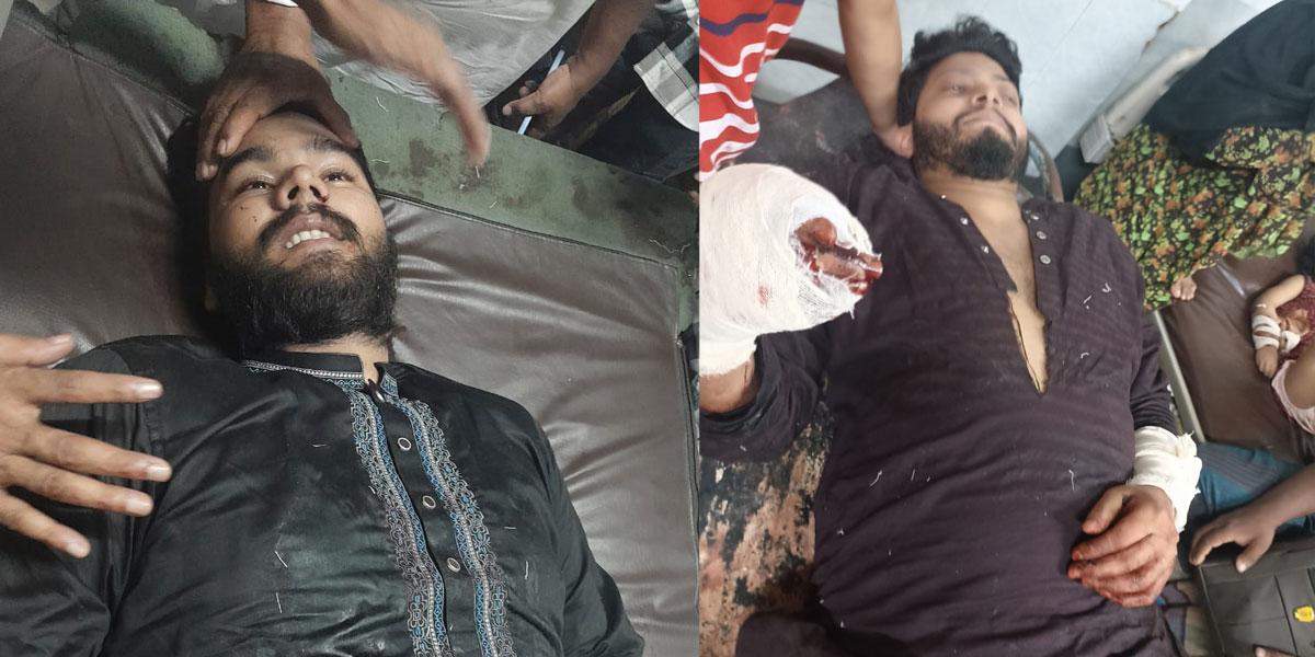 আহতদের অবস্থা আশঙ্কাজনক হওয়ায় ঢাকায় প্রেরণ করা হয়েছে