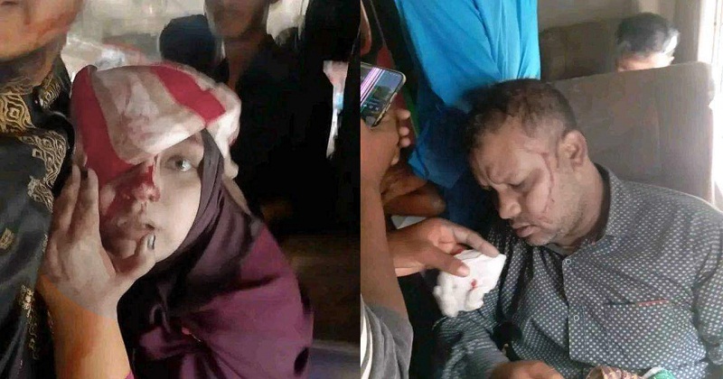 ঢিলের আঘাতে চোখ হারাতে বসেছেন ট্রেনযাত্রী এই নারী